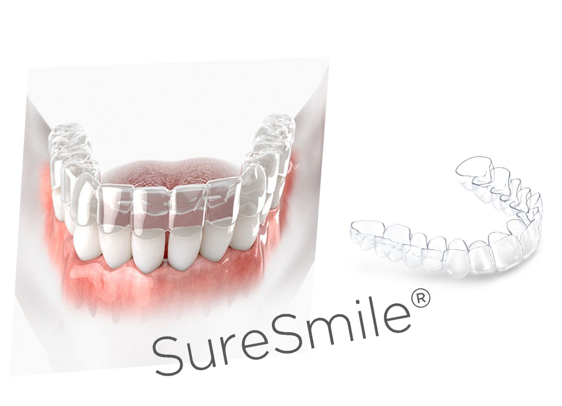 SureSmile - Get the Smile You've Always Wanted